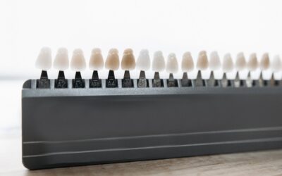 Composite vs Porcelain Veneers: Which Option Is Right for Your Smile?