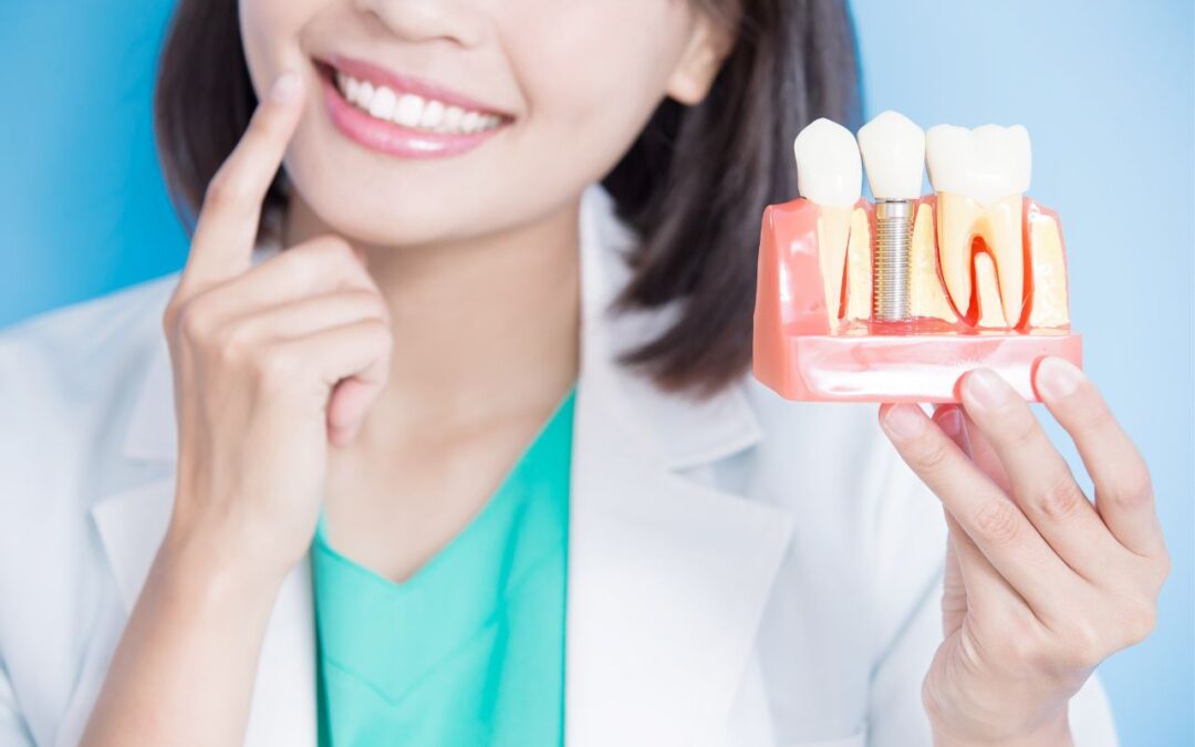 Tooth Implant Cost and Process in Castle Hill: What to Expect Before You Commit