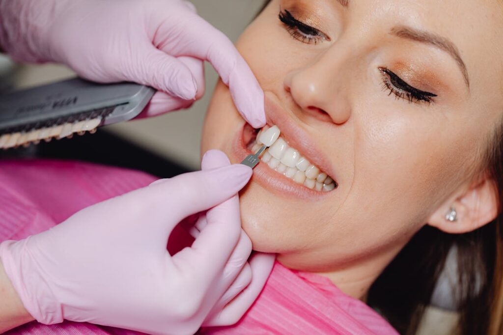 What to Expect When Visiting a Veneers Dentist - Step by Step Guide