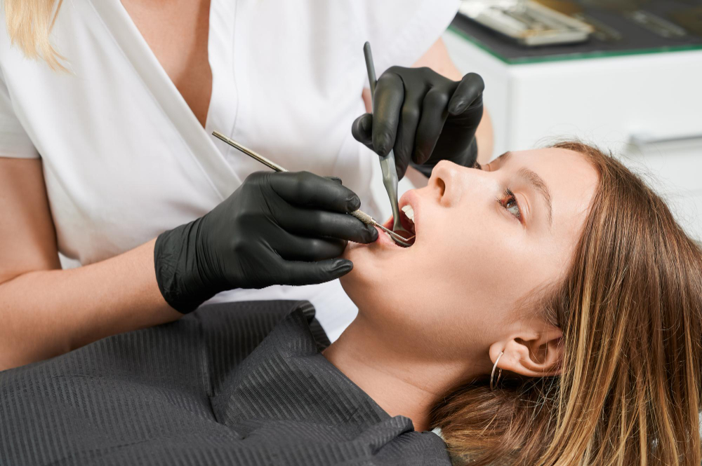 Dental Fillings Fall Out